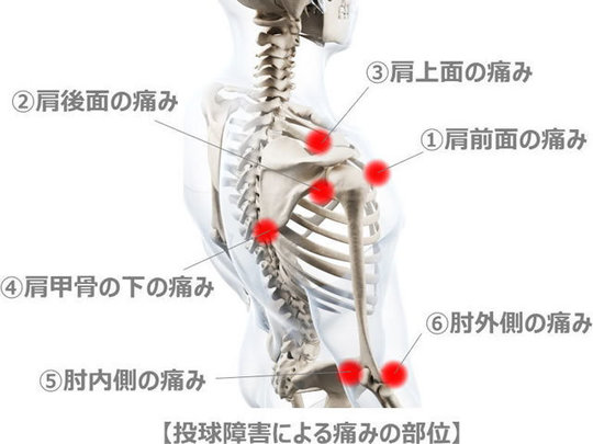 甲骨 が 肩 痛い 付近 肩甲骨が痒いのは、体の中で何が起こっているの？